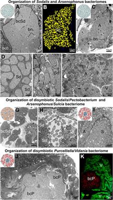 Variable organization of symbiont-containing tissue across planthoppers hosting different heritable endosymbionts